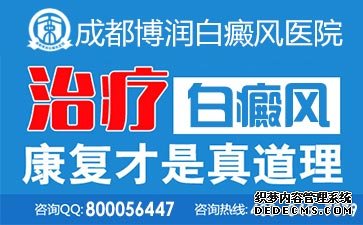 ���综����η�ֹ��ɢ