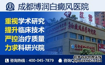 白癜风开始的症状