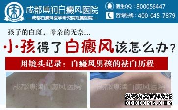 ���综����ʳע��