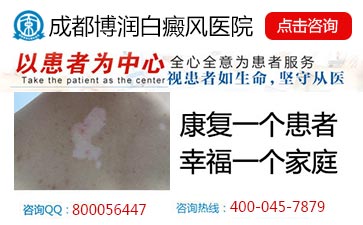 ��������֢״