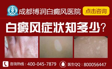 ������õ����Ʒ���