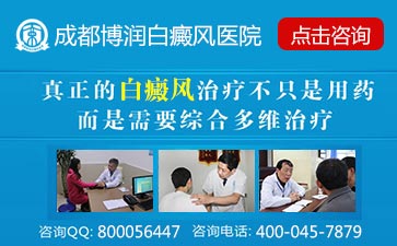 有外伤引起的白癜风怎样治疗